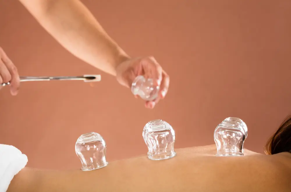 Hijama Cupping Therapy in Faisalabad