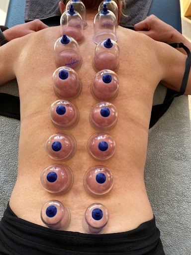 Hijama center in Faisalabad